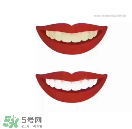 美牙儀能帶上飛機(jī)嗎？美牙儀可以過安檢嗎？