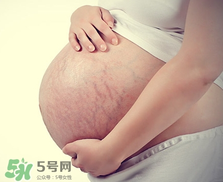 孕婦胸部長(zhǎng)妊娠紋嗎？胸部長(zhǎng)妊娠紋了怎么辦？