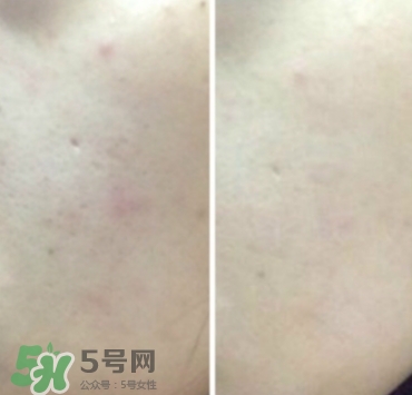 美康粉黛氣墊bb怎么樣？美康粉黛氣墊bb毀容