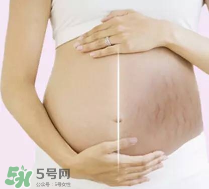 長(zhǎng)妊娠紋的前兆 長(zhǎng)妊娠紋很癢怎么辦？