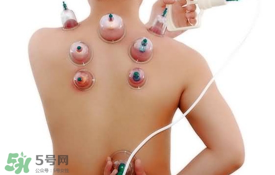 火罐和真空罐哪個(gè)好？真空罐和火罐效果一樣好嗎