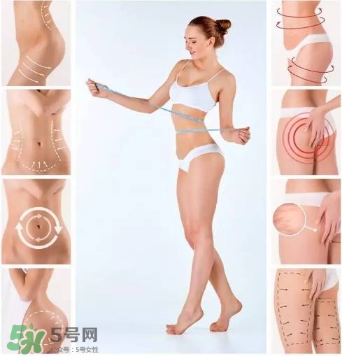 吸脂減肥會反彈嗎？吸脂減肥有沒有后遺癥？