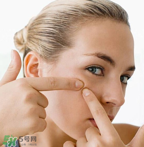 長痘長閉口怎么辦？長痘長閉口是什么原因？