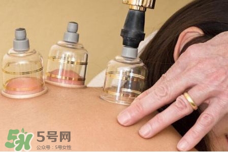 真空拔罐有用嗎？真空拔罐多長時(shí)間合適