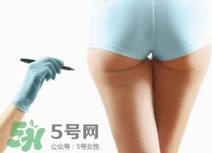 吸脂減肥副作用有哪些？吸脂減肥可靠嗎？