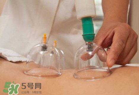真空拔罐有用嗎？真空拔罐多長時(shí)間合適