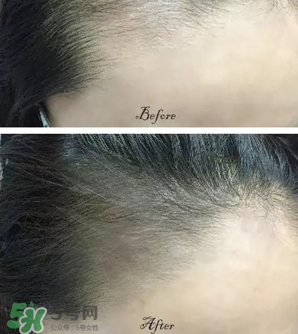 發(fā)際線粉要卸妝嗎_怎么卸？