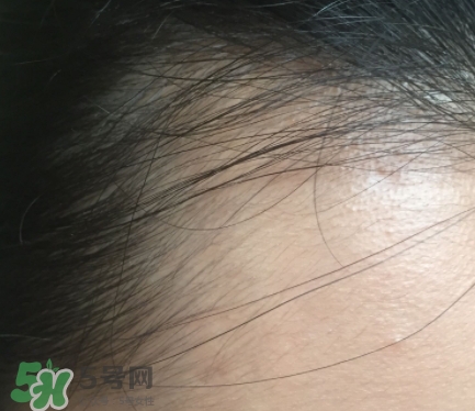 發(fā)際線粉要卸妝嗎_怎么卸？