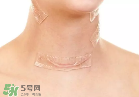 硅膠疤痕貼有用嗎？硅膠疤痕貼效果怎么樣？