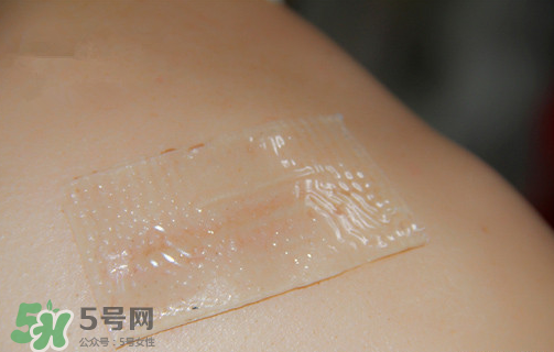 仙卡疤痕貼有用嗎？仙卡疤痕貼效果怎么樣？