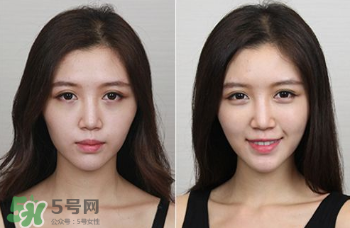 蘋果肌怎么化？蘋果肌究竟哪里好？