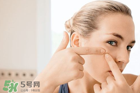 暗瘡可以擠壓嗎？油性和骯臟肌膚會容易有暗瘡嗎？