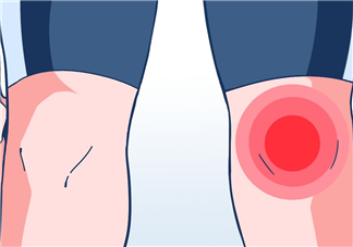 風(fēng)濕可以泡腳嗎？風(fēng)濕可以泡溫泉嗎？