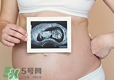 雙子宮可以上環(huán)嗎？雙子宮上環(huán)要注意哪些？