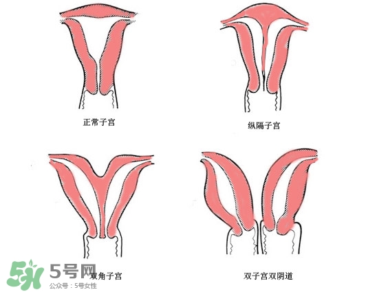 雙子宮是什么意思？雙子宮可以順產(chǎn)嗎？