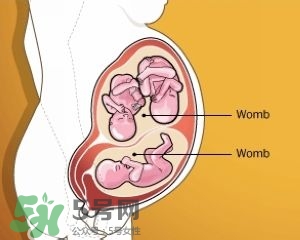 雙子宮是什么意思？雙子宮可以順產(chǎn)嗎？