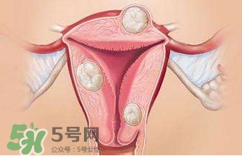 雙子宮可以上環(huán)嗎？雙子宮上環(huán)要注意哪些？