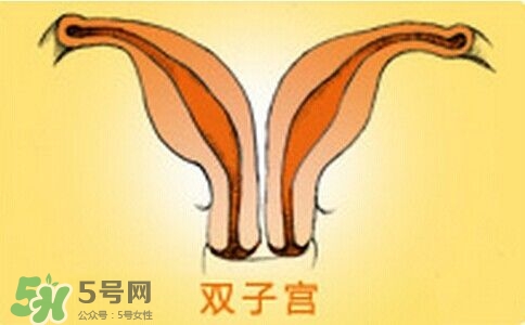 雙子宮是什么意思？雙子宮可以順產(chǎn)嗎？