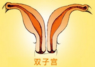 雙子宮是什么意思？雙子宮可以順產(chǎn)嗎？