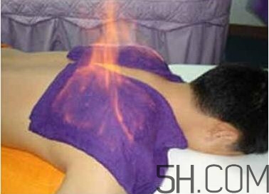 火療真的能治病嗎？火龍液的功效與作用