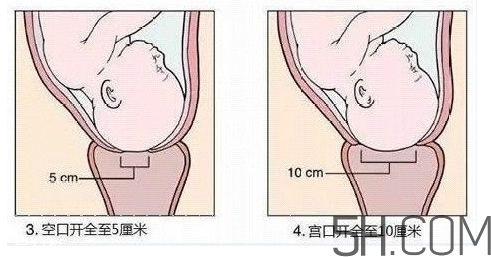 內(nèi)檢是什么感覺？內(nèi)檢有男醫(yī)生嗎？