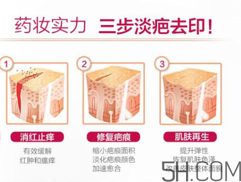 ISDIN怡思丁祛疤膏怎么用？ISDIN怡思丁祛疤膏使用說明