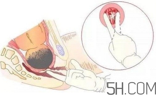 內(nèi)檢是什么感覺？內(nèi)檢有男醫(yī)生嗎？