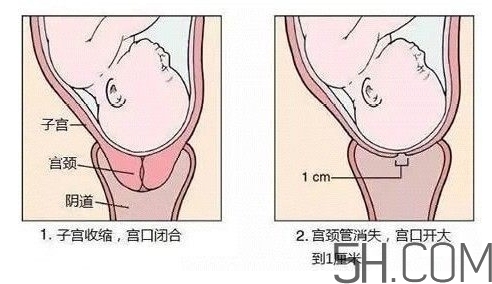 內(nèi)檢是什么感覺？內(nèi)檢有男醫(yī)生嗎？
