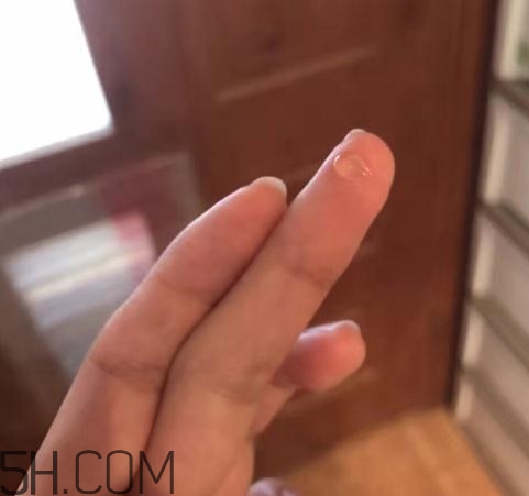 倍舒痕可以去痘印嗎？倍舒痕能涂在痘痘上嗎？