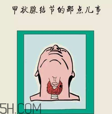 為什么會得甲狀腺結(jié)節(jié)？甲狀腺節(jié)結(jié)是什么？