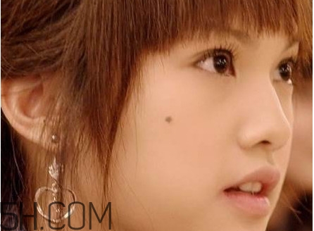 痣是怎么形成的？女人痣長哪里最有福氣
