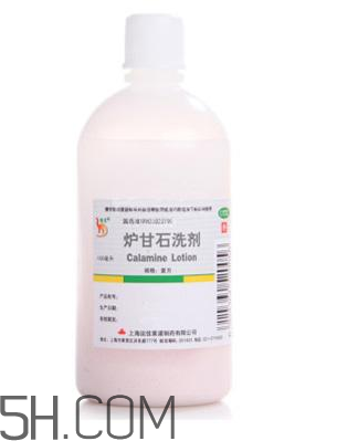 爐甘石洗劑是激素藥嗎？爐甘石洗劑是處方藥嗎？
