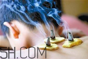 艾灸對慢性咽炎有用嗎？慢性咽炎可以通過艾灸來治療嗎？