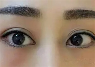 怎么紋美瞳線好看？紋美瞳線的危害