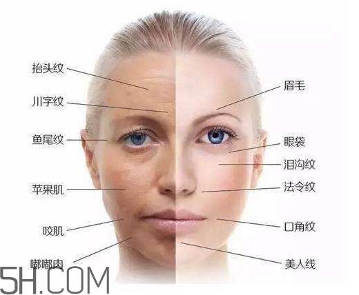 怎么預(yù)防皺紋的產(chǎn)生？導(dǎo)致皺紋的產(chǎn)生的原因有哪些？