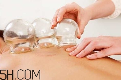 拔罐可以治療鼻炎嗎？鼻炎拔罐拔哪里？