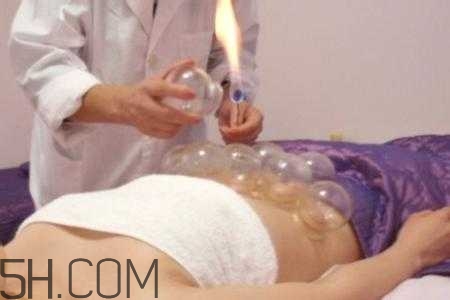 腹部拔罐可以減肥嗎？腹部拔罐拔哪個位置？