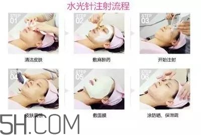 打水光針多久打一次？水光針的誤區(qū)