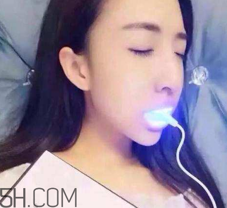 美牙儀可以兩個人用嗎？美牙儀用多久才有作用？