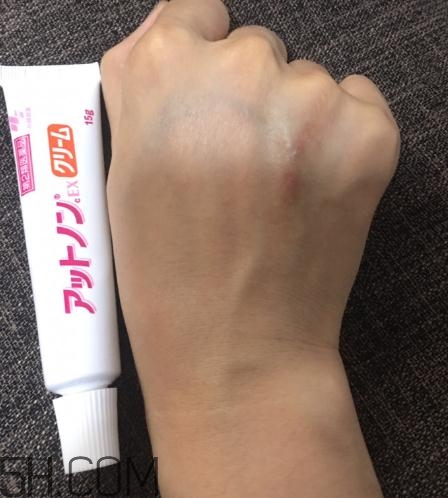 小林制藥祛疤膏有效嗎？小林制藥祛疤膏怎么樣？