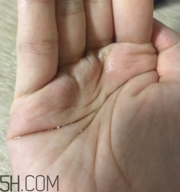 雪肌精卸妝油糊眼睛嗎？雪肌精卸妝油悶痘嗎？