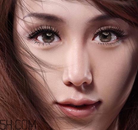 上瞼提肌手術有必要嗎？上瞼提肌后是永久的嗎？
