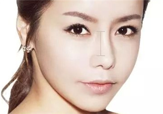 達(dá)拉斯隆鼻是什么材料？達(dá)拉斯隆鼻怎么樣？