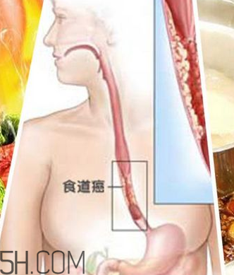 吃太燙會得癌？燙食不僅對胃不好還容易得癌