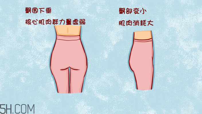臀部護理對健康有什么影響？日常如何保養(yǎng)臀部健康？