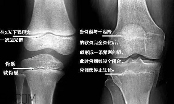 孩子學(xué)街舞好不好？學(xué)街舞好處多多
