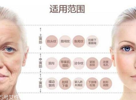 大v線會(huì)斷嗎？一定要選擇正規(guī)整形醫(yī)院