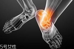 痛風跟飲食有關(guān)？痛風更多與遺傳有關(guān)