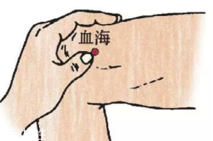 濕疹怎么治才管用？內(nèi)外同治是關(guān)鍵