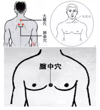 吮痧有什么療效？最溫柔的治病方法